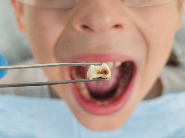 Best Emergency Gum Treatment in Queen Creek, AZ
